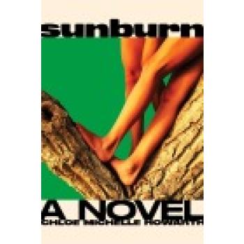 Sunburn